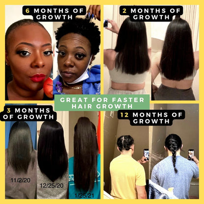 10 in 1 Hair Growth Oil